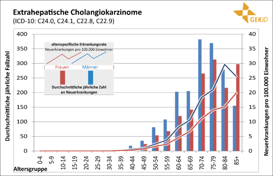 Altersverteilung der Inzidenz maligner biliärer Tumoren in Deutschland (Diagnosejahre 2012-2014) 6 - Malignome der Gallenblase