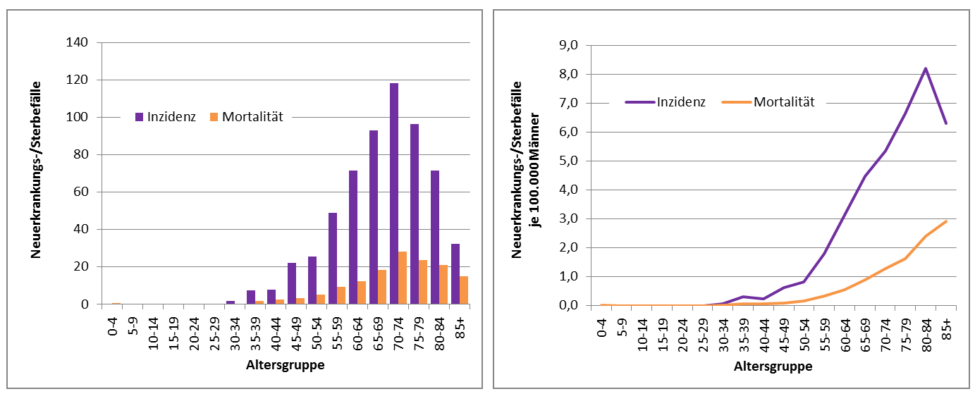 Inzidenz und Mortalität des Mammakarzinoms bei Männern in Deutschland