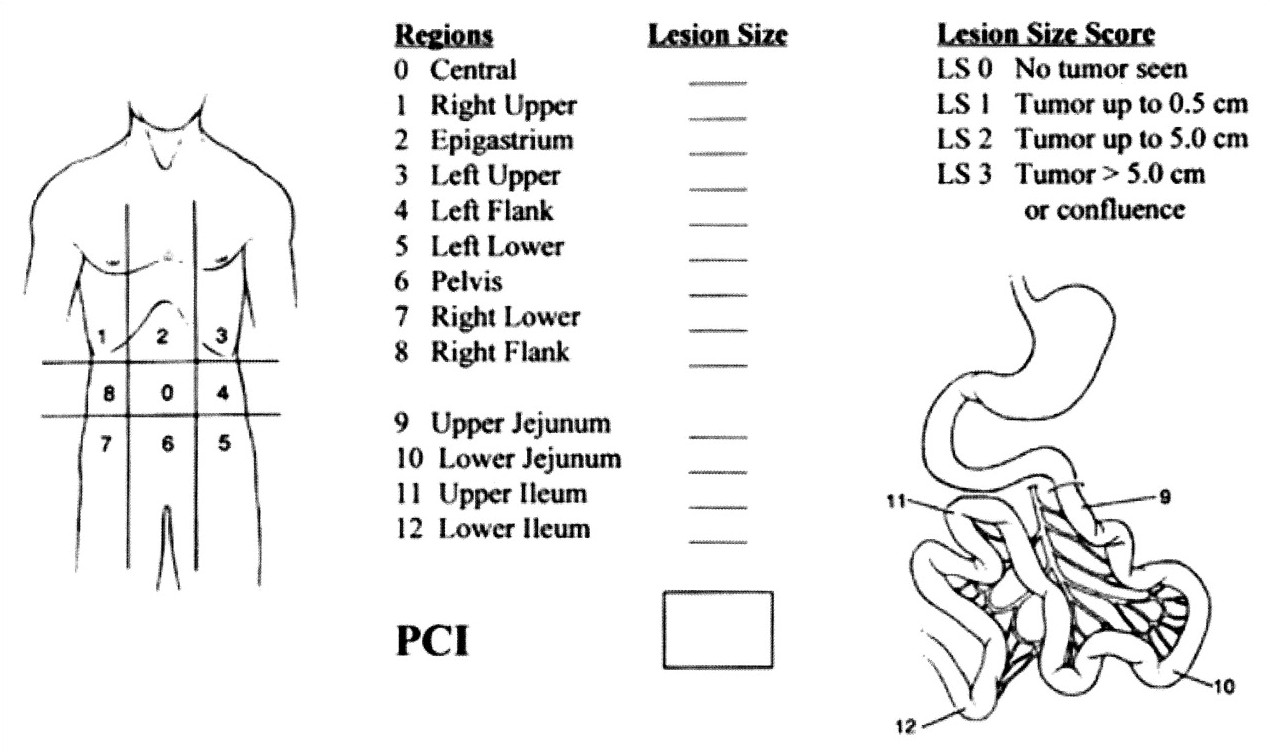 PCI according to Sugarbaker et al 1996 22